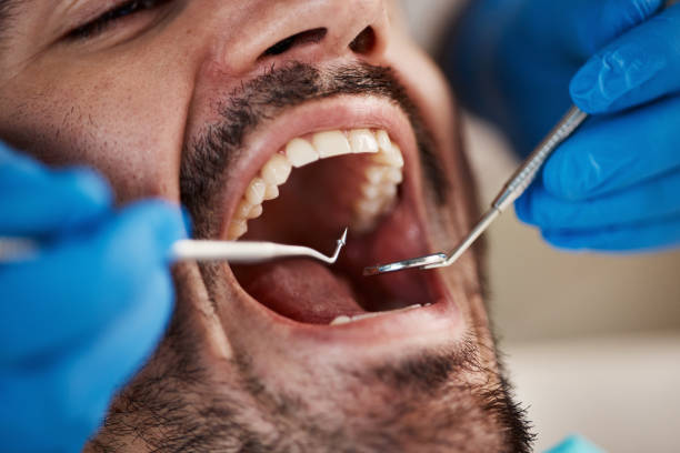 Best Emergency Treatment for Jaw Pain or Injury in Ely, NV